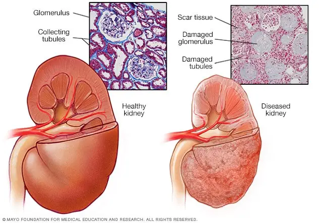 10 Warning Signs Your Kidneys May Be in Danger