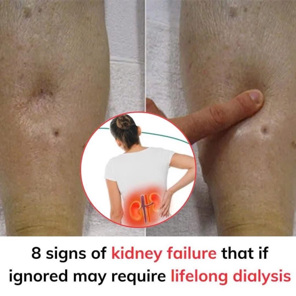 10 Warning Signs Your Kidneys May Be in Danger