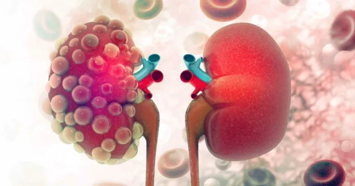 10 Warning Signs Your Kidneys May Be in Danger