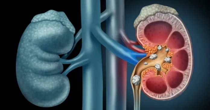 10 Warning Signs Your Kidneys May Be in Danger