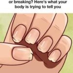 Doctor Reveals 7 Health Issues Hidden in Your Nails